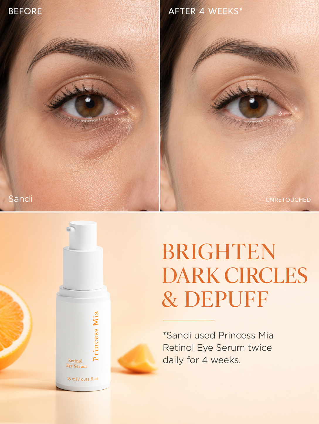 Before and after results demonstrating brighter, smoother under-eyes after four weeks of using Princess Mia Retinol Eye Serum to reduce the appearance of dark circles and puffiness.